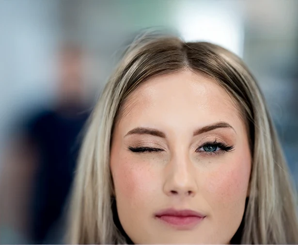 Blepharoplasty